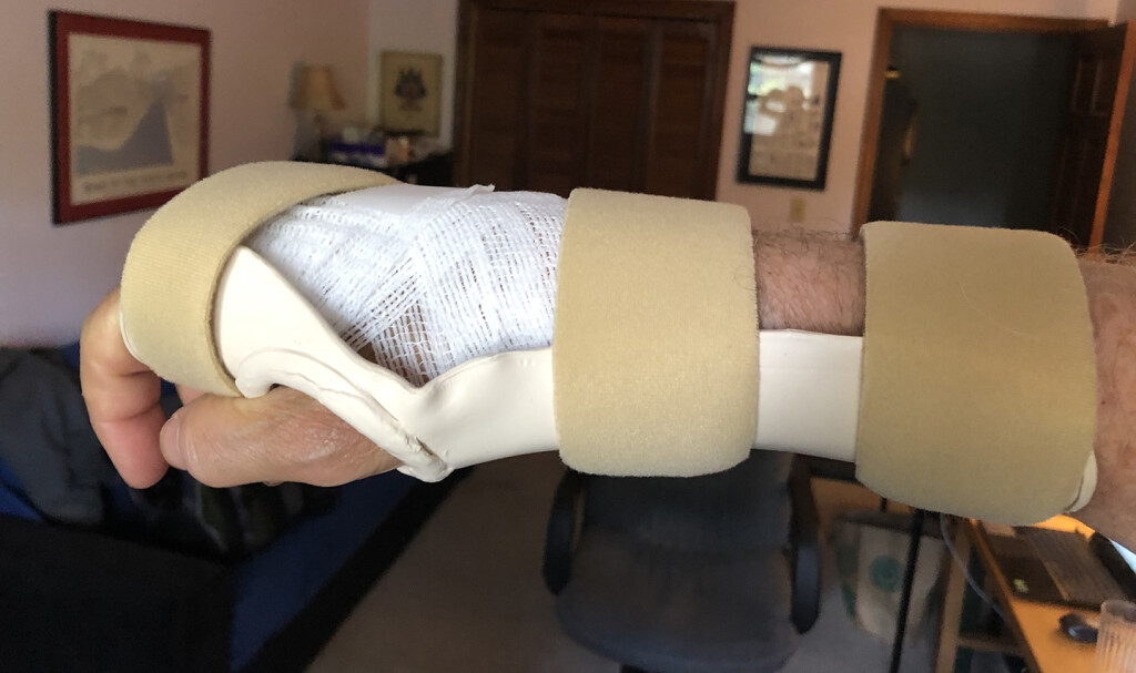 splint